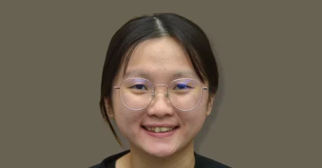 新案例-術前全臉照1